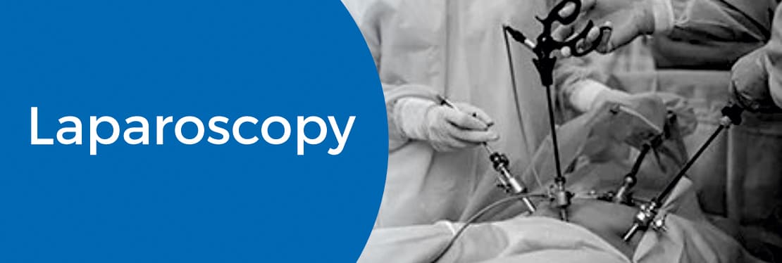 A team of doctors examing a patient through laparoscopy  in Milann Fertility center.